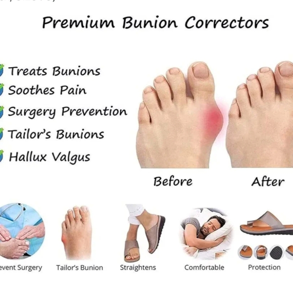 Sandal Foot Correction - Picture 4 of 4